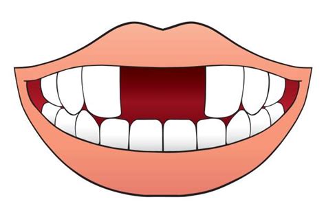 10 Jaw Deterioration Illustrations Royalty Free Vector Graphics