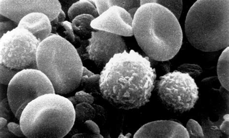 Promising Early Results On Universal Blood Test For Cancer