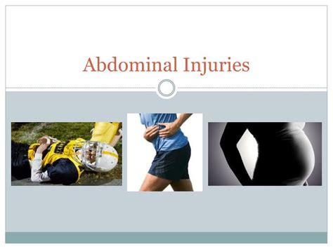 Ppt Abdominal Injuries Powerpoint Presentation Free Download Id