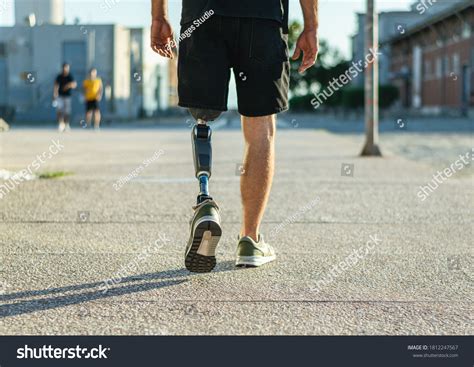 Prosthetic Legs Images Stock Photos And Vectors Shutterstock