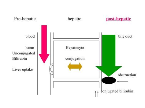 Výsledok Vyhľadávania Obrázkov Pre Dopyt Post Hepatic Jaundice Pre