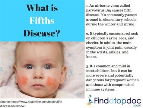 What Is Fifths Disease Causes And Treatment Infographic