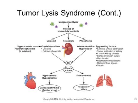 Tumor Lysis Syndrome Causes Symptoms Treatment