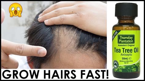How To Use Tea Tree Oil For Hair Growth 😍 How To Get Long Hairs Fast By