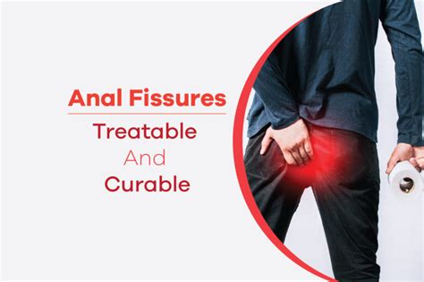 Anal Fissures Treatable And Curable