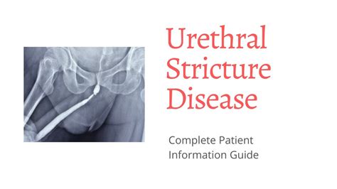 Male Urethral Stricture Symptoms Investigations And Treatment Guide I Bangalore Youtube