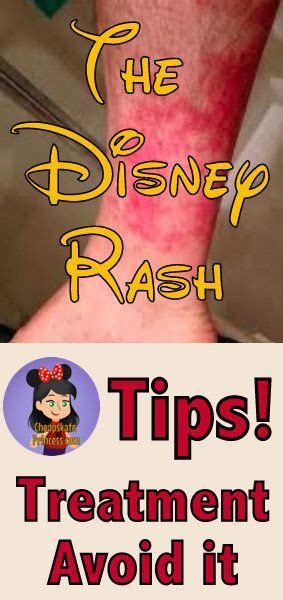 The Disney Rash How To Beat It Disneys Cheapskate Princess