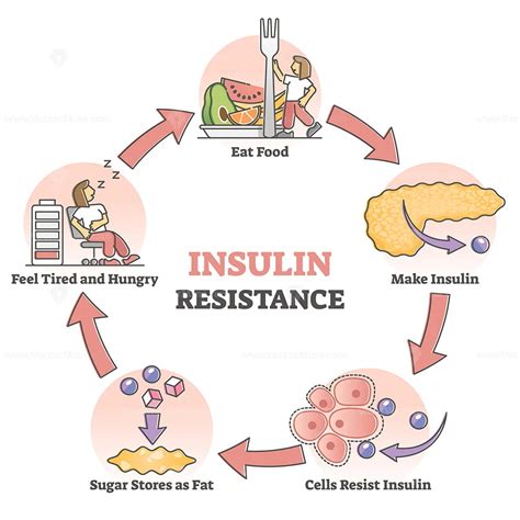 Insulin Resistance Pathological Health Condition Educational Outline Diagram Vectormine