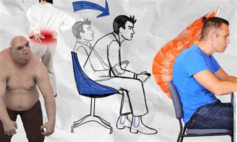 Forward Leaning Gamer Postures Rated By Physical Therapists
