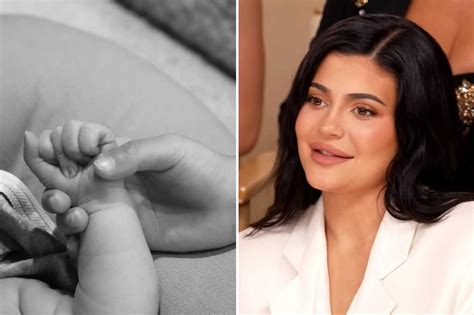 kylie jenner accused of getting ‘botched lip fillers as