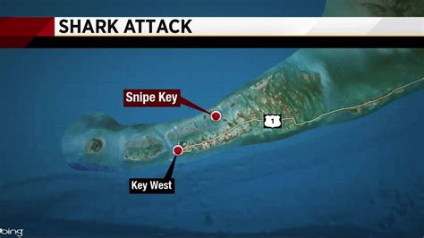 Shark Attack In Florida Keys Leaves Woman Injured Youtube