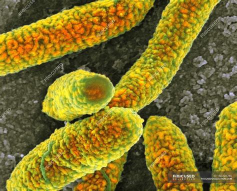 Escherichia Coli Bacteria — Microbial Micrograph Stock Photo