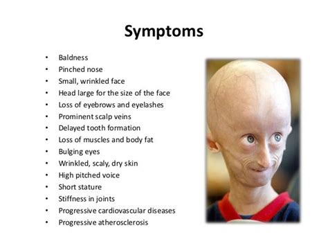 Hutchinson Gilford Progeria Syndrome