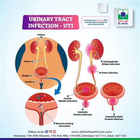 Urinary Tract Infection Uti