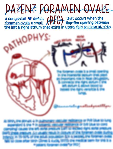 Patent Foramen Ovale Pfo Etsy