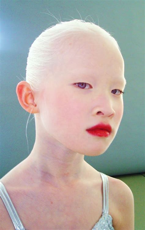 Asian Albino Girl Eyes Pinterest Girls