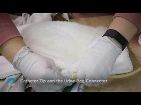 How To Fill Bladder With Catheter