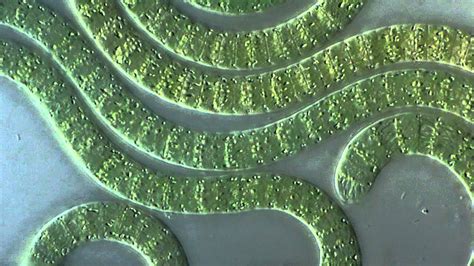 Cyanobacteria Under Microscope Youtube