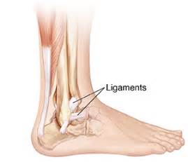 A torn ligament severely limits this results in the inability to pivot, turn, or twist the leg. Understanding Ankle Sprain