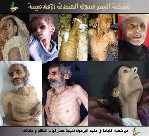 Starvation A Twisted Example Of The Assad Regimes Terrorism Syria