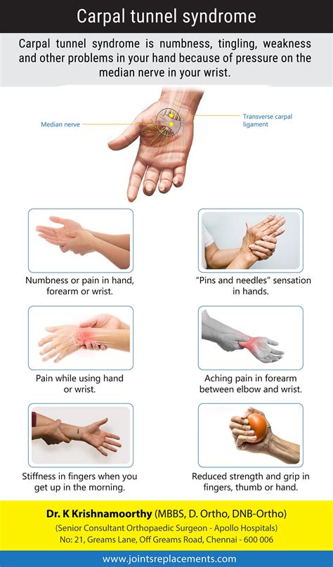 Carpal Tunnel Syndrome A Numbness And Tingling In The Hand And By Joints Replacements Medium