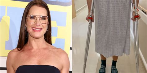 What Will Brooke Shields Recovery From Femur Fracture Be Like