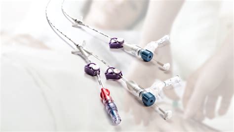 Midline Catheter Advantages Over A Traditional Cannula Needle
