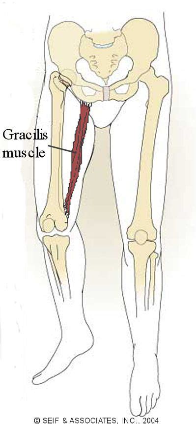 We think this is the most useful anatomy picture that you need. Gracilis Pain | gracilis syndrome is a condition that ...