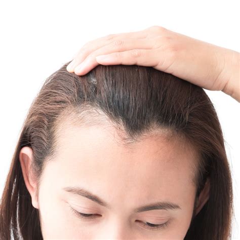 Signs Of New Hair Growth On Scalp Signs Of New Hair Growth How To