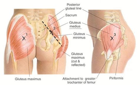 (proximal attachments) a.surface of ilium posterior to posterior gluteal line and posterior inferior surface of sacrum and coccyx. Gluteal Tendinopathy in Melbourne