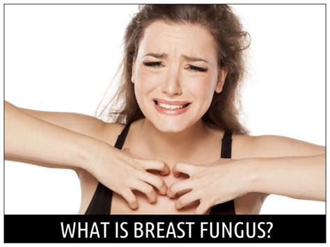 Breast Fungus What Causes Infection Around The Breast
