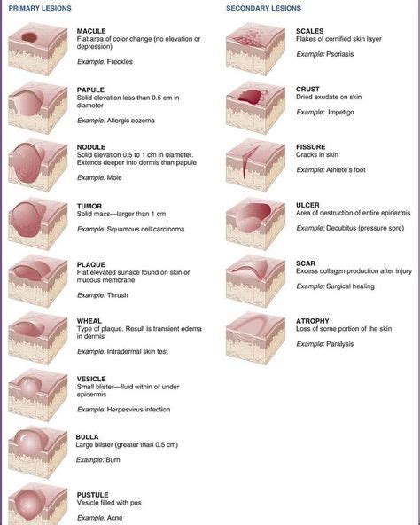 Medical Case Presentation 在 Instagram 上发布：“🔹️different Types Of Skin