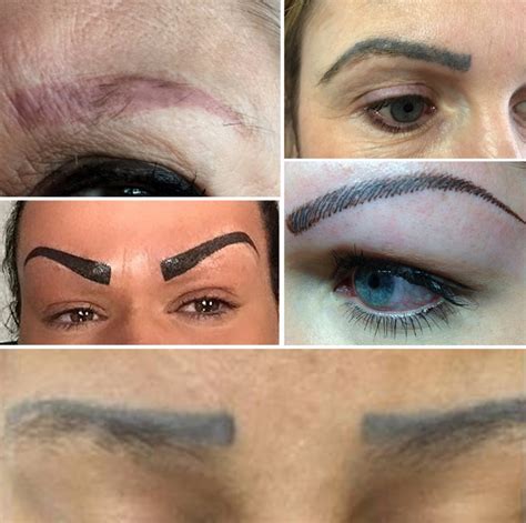 11+ Permanent Eyebrow Tattoo Removal Before And After Background
