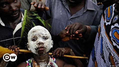 Ugandan Circumcision Ceremony Becomes A Tourist Attraction Africa Dw 24 08 2016