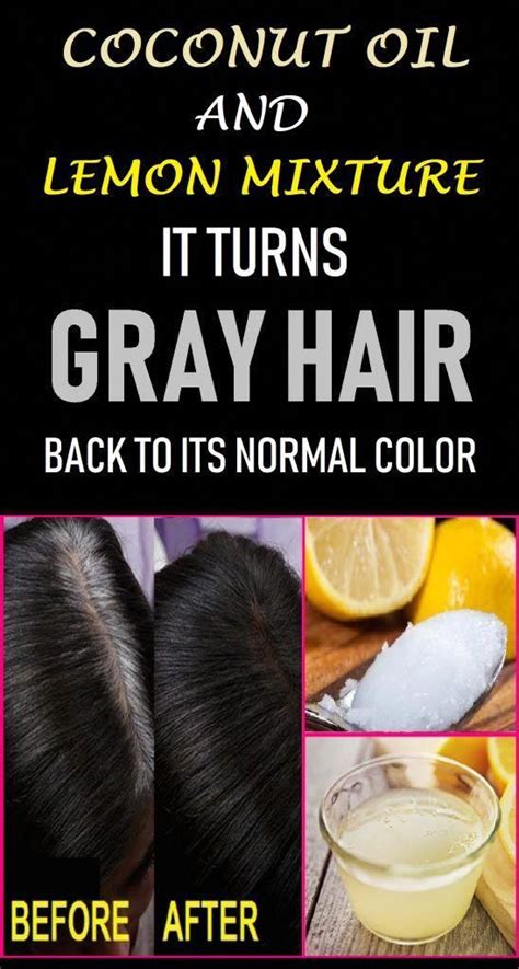 How To Get Rid Of Hair Fall Naturally Tips And Tricks Best Simple
