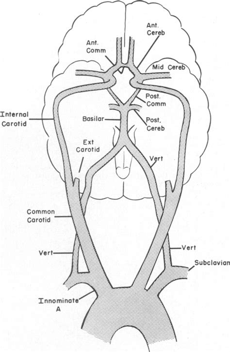 Surgical Management Of Varying Patterns Of Vertebral Artery And