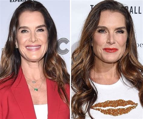 Brooke Shields Before And After Plastic Surgery