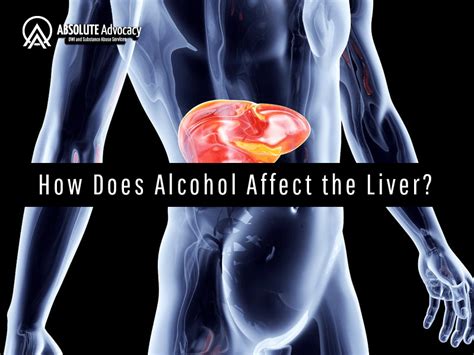 How Does Alcohol Affect The Liver Absolute Advocacy