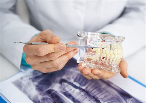 What To Expect With Dental Implant Surgery Dansville Dental