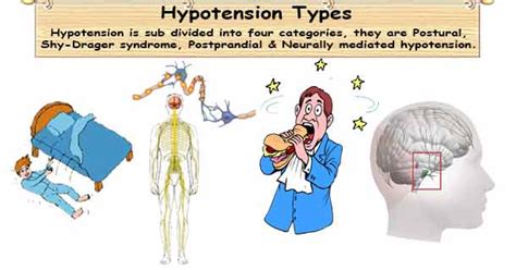 Low Blood Pressure Types 4 Categories Of Hypotension Low Bp