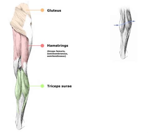 These muscles, including the gluteus maximus and the hamstrings, extend the thigh at the hip in support of the body's weight and propulsion. I want to learn About Spina Bifida: Lesions, Levels, Sensory and Mobility