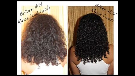 Coming to scalp, it works amazingly in avoiding the scalp and hair problems to make your scalp healthy and shiny. Organic Apple Cider Vinegar hair Cleanser #OrganicBeauty ...