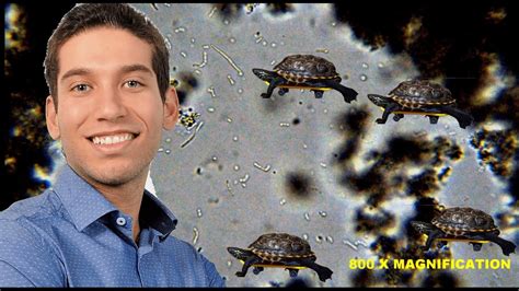 Red blood cells under the microscope hypo and hypertonic solutions. YOGURT BACTERIA UNDER MICROSCOPE (2000x Magnification ...