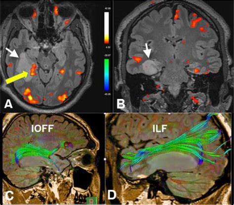 Frontiers Advances In Brain Imaging Techniques For Patients With