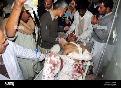 An injured victim of explosion who was injured in remote 