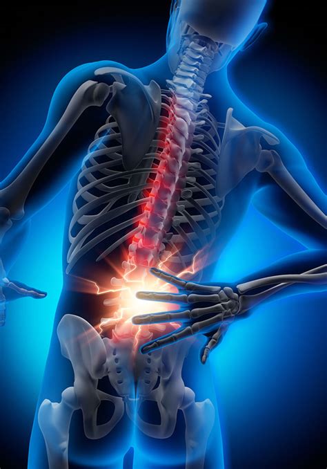Brace For Lower Back Pain Cheapest Deals Save 60 Jlcatjgobmx