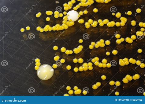 Yellow Bacteria Colonies On A Petri Plate Stock Photo Image Of