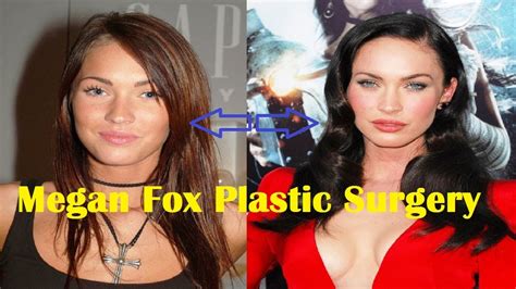 Megan Fox Before and After Plastic Surgery - YouTube