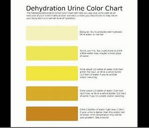 Dehydration Urine Color Chart Infographic Health Color Of Urine
