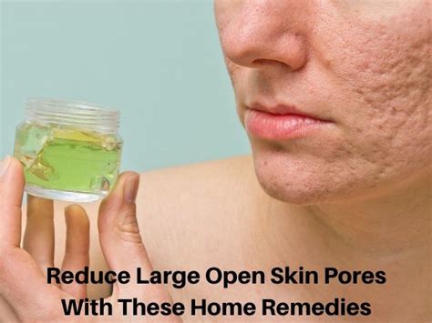 Reduce Large Skin Pores Fast With These Home Remedies 2023